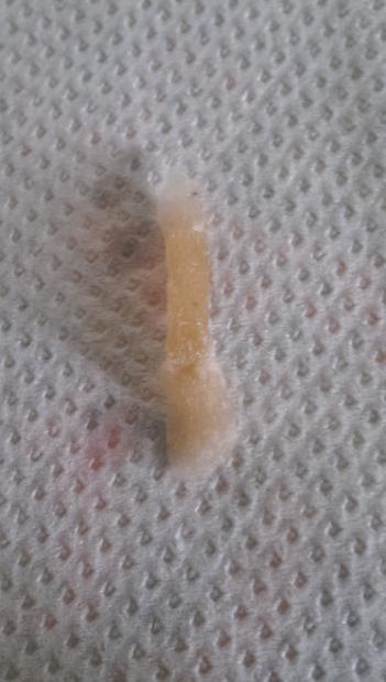 RIGENERAZIONE: TECNICA SCOTTISH ROLL [SigarettaElettronicaForum.com]