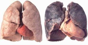 Nuova legge ecig 2017-2018 e monopolio di stato [SigarettaElettronicaForum.com]
